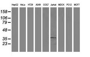 ACY3 Antibody - Western blot of extracts (35 ug) from 9 different cell lines by using anti-ACY3 monoclonal antibody (HepG2: human; HeLa: human; SVT2: mouse; A549: human; COS7: monkey; Jurkat: human; MDCK: canine; PC12: rat; MCF7: human).