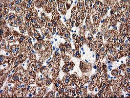 ACY3 Antibody - IHC of paraffin-embedded Human liver tissue using anti-ACY3 mouse monoclonal antibody.