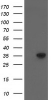 ACY3 Antibody - HEK293T cells were transfected with the pCMV6-ENTRY control (Left lane) or pCMV6-ENTRY ACY3 (Right lane) cDNA for 48 hrs and lysed. Equivalent amounts of cell lysates (5 ug per lane) were separated by SDS-PAGE and immunoblotted with anti-ACY3.
