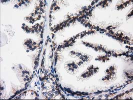 ACY3 Antibody - IHC of paraffin-embedded Human prostate tissue using anti-ACY3 mouse monoclonal antibody.