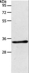 ACY3 Antibody - Western blot analysis of Mouse kidney tissue, using ACY3 Polyclonal Antibody at dilution of 1:500.