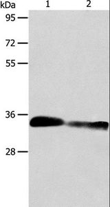 ACY3 Antibody - Western blot analysis of Mouse kidney and rat kidney tissue, using ACY3 Polyclonal Antibody at dilution of 1:750.