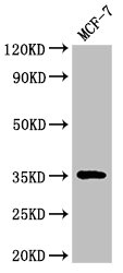 ACY3 Antibody - Positive Western Blot detected in MCF-7 whole cell lysate. All lanes: ACY3 antibody at 3 µg/ml Secondary Goat polyclonal to rabbit IgG at 1/50000 dilution. Predicted band size: 36 KDa. Observed band size: 36 KDa