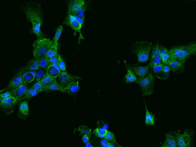 ACY3 Antibody - Immunofluorescence staining of ACY3 in A431 cells. Cells were fixed with 4% PFA, permeabilzed with 0.1% Triton X-100 in PBS, blocked with 10% serum, and incubated with rabbit anti-Human ACY3 polyclonal antibody (dilution ratio 1:200) at 4°C overnight. Then cells were stained with the Alexa Fluor 488-conjugated Goat Anti-rabbit IgG secondary antibody (green) and counterstained with DAPI (blue). Positive staining was localized to Cytoplasm.