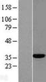 ACY3 Protein - Western validation with an anti-DDK antibody * L: Control HEK293 lysate R: Over-expression lysate