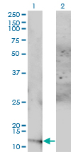ACYP1 Antibody - Western Blot analysis of ACYP1 expression in transfected 293T cell line by ACYP1 monoclonal antibody (M01), clone 1B2-3A2.Lane 1: ACYP1 transfected lysate(11.3 KDa).Lane 2: Non-transfected lysate.