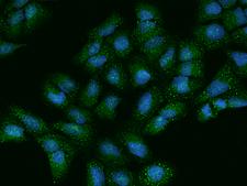 ACYP1 Antibody - Immunofluorescence staining of ACYP1 in U2OS cells. Cells were fixed with 4% PFA, permeabilzed with 0.1% Triton X-100 in PBS, blocked with 10% serum, and incubated with rabbit anti-Human ACYP1 polyclonal antibody (dilution ratio 1:100) at 4°C overnight. Then cells were stained with the Alexa Fluor 488-conjugated Goat Anti-rabbit IgG secondary antibody (green) and counterstained with DAPI (blue). Positive staining was localized to Nucleus and Cytoplasm.