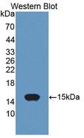 ACYP2 Antibody - Western blot of ACYP2 antibody.