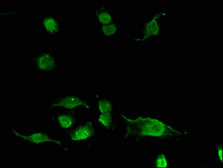 ACYP2 Antibody - Immunofluorescent analysis of U251 cells using ACYP2 Antibody at a dilution of 1:100 and Alexa Fluor 488-congugated AffiniPure Goat Anti-Rabbit IgG(H+L)