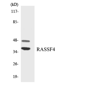 AD037 / RASSF4 Antibody - Western blot analysis of the lysates from RAW264.7cells using RASSF4 antibody.