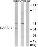 AD037 / RASSF4 Antibody - Western blot analysis of lysates from COLO and HUVEC cells, using RASSF4 Antibody. The lane on the right is blocked with the synthesized peptide.