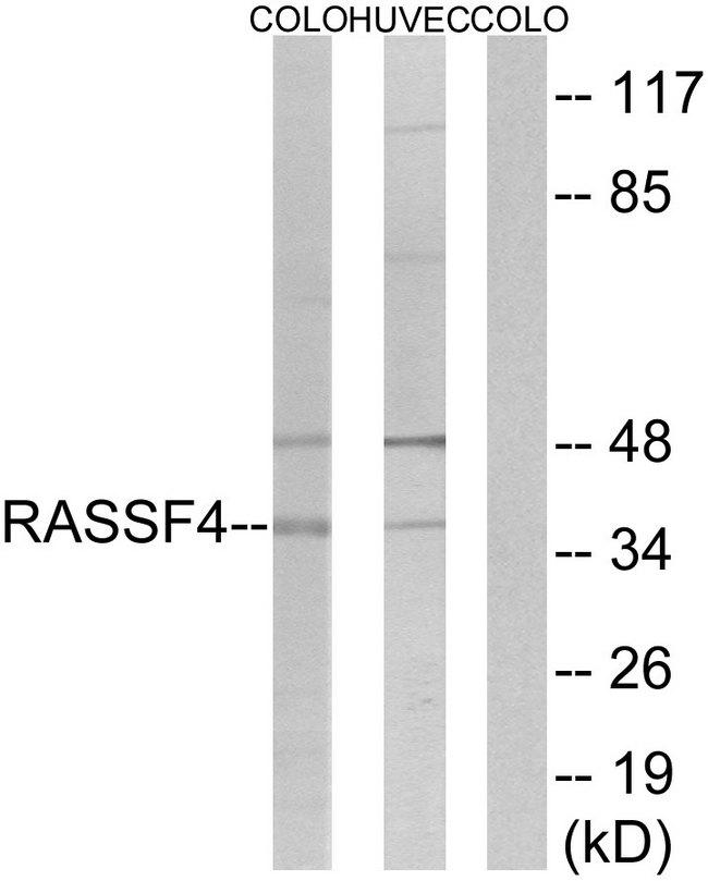 AD037 / RASSF4 Antibody - Western blot analysis of extracts from COLO cells and HUVEC cells, using RASSF4 antibody.