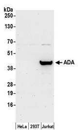 ADA / Adenosine Deaminase Antibody - Detection of human ADA by western blot. Samples: Whole cell lysate (50 µg) from HeLa, HEK293T, and Jurkat cells prepared using NETN lysis buffer. Antibody: Affinity purified rabbit anti-ADA antibody used for WB at 0.1 µg/ml. Detection: Chemiluminescence with an exposure time of 30 seconds.