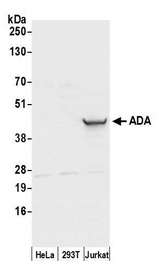 ADA / Adenosine Deaminase Antibody - Detection of human ADA by western blot. Samples: Whole cell lysate (50 µg) from HeLa, HEK293T, and Jurkat cells prepared using NETN lysis buffer. Antibody: Affinity purified rabbit anti-ADA antibody used for WB at 0.1 µg/ml. Detection: Chemiluminescence with an exposure time of 3 seconds.