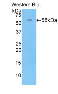 ADA / Adenosine Deaminase Antibody - Western blot of recombinant ADA / Adenosine Deaminase.  This image was taken for the unconjugated form of this product. Other forms have not been tested.