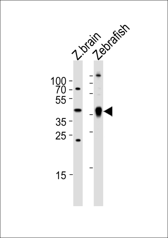 ADA / Adenosine Deaminase Antibody - Western blot of lysates from zebra fish brain and Zebrafish tissue lysate (from left to right) with (DANRE) ada Antibody. Antibody was diluted at 1:1000 at each lane. A goat anti-rabbit IgG H&L (HRP) at 1:5000 dilution was used as the secondary antibody. Lysates at 35 ug per lane.