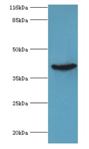 ADA / Adenosine Deaminase Antibody - Western blot. All. lanes: ADA antibody at 2 ug/ml+Jurkat whole cell lysate. Secondary antibody: goat polyclonal to rabbit at 1:10000 dilution. Predicted band size: 41 kDa. Observed band size: 41 kDa.  This image was taken for the unconjugated form of this product. Other forms have not been tested.