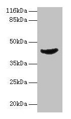 ADA / Adenosine Deaminase Antibody - Western blot All lanes: ADA antibody at 2µg/ml + jurkat whole cell lysate Secondary Goat polyclonal to rabbit IgG at 1/10000 dilution Predicted band size: 41 kDa Observed band size: 41 kDa
