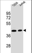 ADA / Adenosine Deaminase Antibody - ADA Antibody western blot of CEM,Jurkat cell line lysates (35 ug/lane). The ADA antibody detected the ADA protein (arrow).