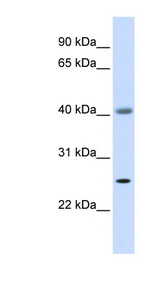 ADA / Adenosine Deaminase Antibody - ADA / Adenosine Deaminase antibody western blot of Fetal Muscle lysate.  This image was taken for the unconjugated form of this product. Other forms have not been tested.