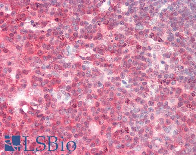 ADA / Adenosine Deaminase Antibody - Human Thymus: Formalin-Fixed, Paraffin-Embedded (FFPE).  This image was taken for the unconjugated form of this product. Other forms have not been tested.