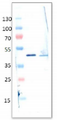 ADA / Adenosine Deaminase Antibody - Lane 1: mw markers; Lane 2: recombinant human ADA; Lane 3: calf spleen ADA.