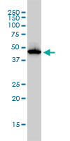 ADA / Adenosine Deaminase Antibody - ADA monoclonal antibody (M01), clone 4G4-1C6. Western Blot analysis of ADA expression in Jurkat.