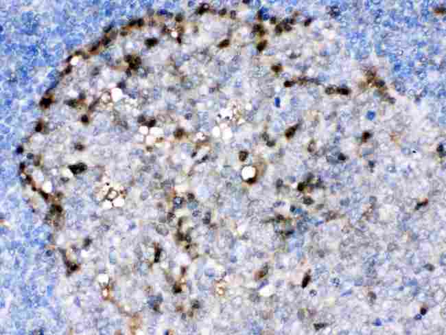ADA / Adenosine Deaminase Antibody - ADA was detected in paraffin-embedded sections of human tonsil tissues using rabbit anti- ADA Antigen Affinity purified polyclonal antibod