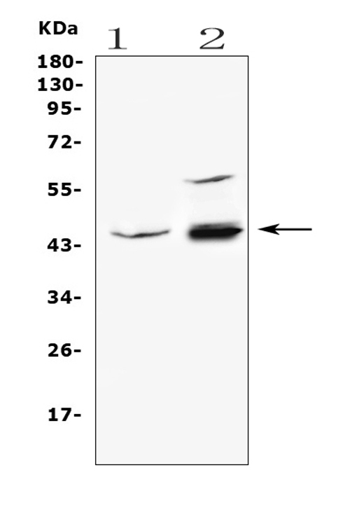 ADA / Adenosine Deaminase Antibody - Western blot analysis of ADA using anti-ADA antibody. Electrophoresis was performed on a 5-20% SDS-PAGE gel at 70V (Stacking gel) / 90V (Resolving gel) for 2-3 hours. The sample well of each lane was loaded with 50ug of sample under reducing conditions. Lane 1: human placenta tissue lysates, Lane 2: human 22RV1 whole cell lysates, After Electrophoresis, proteins were transferred to a Nitrocellulose membrane at 150mA for 50-90 minutes. Blocked the membrane with 5% Non-fat Milk/ TBS for 1.5 hour at RT. The membrane was incubated with rabbit anti-ADA antigen affinity purified polyclonal antibody at 0.5 µg/mL overnight at 4°C, then washed with TBS-0.1% Tween 3 times with 5 minutes each and probed with a goat anti-rabbit IgG-HRP secondary antibody at a dilution of 1:10000 for 1.5 hour at RT. The signal is developed using an Enhanced Chemiluminescent detection (ECL) kit with Tanon 5200 system. A specific band was detected for ADA at approximately 45KD. The expected band size for ADA is at 40KD.