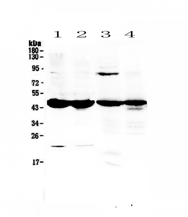 ADA / Adenosine Deaminase Antibody - Western blot - Anti-ADA/Adenosine Deaminase Picoband antibody