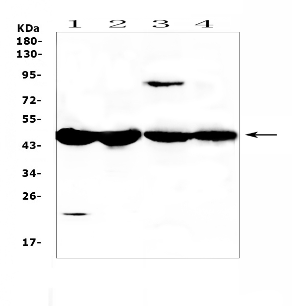ADA / Adenosine Deaminase Antibody - Western blot analysis of ADA using anti-ADA antibody. Electrophoresis was performed on a 5-20% SDS-PAGE gel at 70V (Stacking gel) / 90V (Resolving gel) for 2-3 hours. The sample well of each lane was loaded with 50ug of sample under reducing conditions. Lane 1: mouse testis tissue lysates,Lane 2: mouse ovary tissue lysates,Lane 3: rat stomach tissue lysates,Lane 4: rat ovary tissue lysates. After Electrophoresis, proteins were transferred to a Nitrocellulose membrane at 150mA for 50-90 minutes. Blocked the membrane with 5% Non-fat Milk/ TBS for 1.5 hour at RT. The membrane was incubated with rabbit anti-ADA antigen affinity purified polyclonal antibody at 0.5 µg/mL overnight at 4°C, then washed with TBS-0.1% Tween 3 times with 5 minutes each and probed with a goat anti-rabbit IgG-HRP secondary antibody at a dilution of 1:10000 for 1.5 hour at RT. The signal is developed using an Enhanced Chemiluminescent detection (ECL) kit with Tanon 5200 system. A specific band was detected for ADA at approximately 45KD. The expected band size for ADA is at 40KD.
