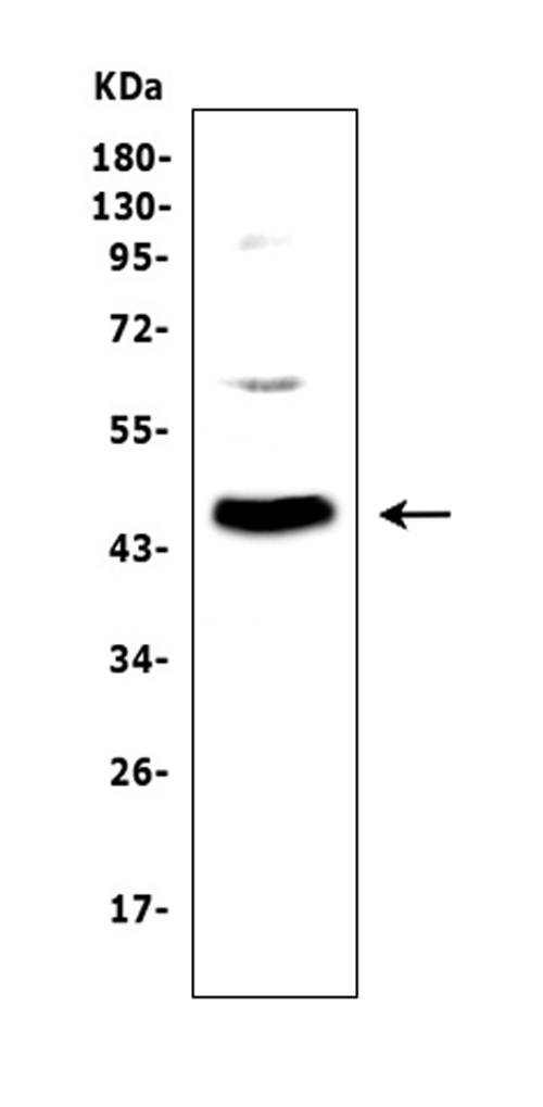 ADA / Adenosine Deaminase Antibody - Western blot analysis of ADA using anti-ADA antibody. Electrophoresis was performed on a 5-20% SDS-PAGE gel at 70V (Stacking gel) / 90V (Resolving gel) for 2-3 hours. The sample well of each lane was loaded with 50ug of sample under reducing conditions. Lane 1: human placenta tissue lysates. After Electrophoresis, proteins were transferred to a Nitrocellulose membrane at 150mA for 50-90 minutes. Blocked the membrane with 5% Non-fat Milk/ TBS for 1.5 hour at RT. The membrane was incubated with rabbit anti-ADA antigen affinity purified polyclonal antibody at 0.5 µg/mL overnight at 4°C, then washed with TBS-0.1% Tween 3 times with 5 minutes each and probed with a goat anti-rabbit IgG-HRP secondary antibody at a dilution of 1:10000 for 1.5 hour at RT. The signal is developed using an Enhanced Chemiluminescent detection (ECL) kit with Tanon 5200 system. A specific band was detected for ADA at approximately 45KD. The expected band size for ADA is at 40KD.