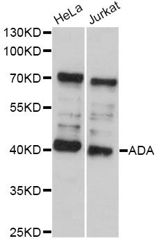 ADA / Adenosine Deaminase Antibody - Western blot analysis of extracts of various cell lines, using ADA antibody at 1:1000 dilution. The secondary antibody used was an HRP Goat Anti-Rabbit IgG (H+L) at 1:10000 dilution. Lysates were loaded 25ug per lane and 3% nonfat dry milk in TBST was used for blocking. An ECL Kit was used for detection and the exposure time was 10s.