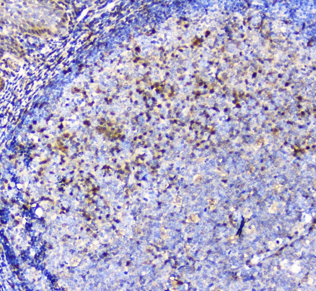 ADA / Adenosine Deaminase Antibody - IHC analysis of ADA using anti-ADA antibody. ADA was detected in paraffin-embedded section of human tonsil tissue. Heat mediated antigen retrieval was performed in citrate buffer (pH6, epitope retrieval solution) for 20 mins. The tissue section was blocked with 10% goat serum. The tissue section was then incubated with 1µg/ml mouse anti-ADA Antibody overnight at 4°C. Biotinylated goat anti-mouse IgG was used as secondary antibody and incubated for 30 minutes at 37°C. The tissue section was developed using Strepavidin-Biotin-Complex (SABC) with DAB as the chromogen.