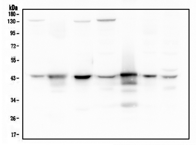 ADA / Adenosine Deaminase Antibody - Western blot analysis of ADA using anti-ADA antibody. Electrophoresis was performed on a 5-20% SDS-PAGE gel at 70V (Stacking gel) / 90V (Resolving gel) for 2-3 hours. The sample well of each lane was loaded with 50ug of sample under reducing conditions. Lane 1: human Hela whole cell lysates, Lane 2: human placenta tissue lysates, Lane 3: human A549 whole cell lysates, Lane 4: human MCF-7 whole cell lysates, Lane 5: human U-937 whole cell lysates, Lane 6: human U20S whole cell lysates, Lane 7: human Caco-2 whole cell lysates. After Electrophoresis, proteins were transferred to a Nitrocellulose membrane at 150mA for 50-90 minutes. Blocked the membrane with 5% Non-fat Milk/ TBS for 1.5 hour at RT. The membrane was incubated with mouse anti-ADA antigen affinity purified monoclonal antibody at 0.5 µg/mL overnight at 4°C, then washed with TBS-0.1% Tween 3 times with 5 minutes each and probed with a goat anti-mouse IgG-HRP secondary antibody at a dilution of 1:10000 for 1.5 hour at RT. The signal is developed using an Enhanced Chemiluminescent detection (ECL) kit with Tanon 5200 system.