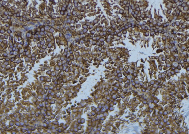 ADA / Adenosine Deaminase Antibody - 1:100 staining mouse testis tissue by IHC-P. The sample was formaldehyde fixed and a heat mediated antigen retrieval step in citrate buffer was performed. The sample was then blocked and incubated with the antibody for 1.5 hours at 22°C. An HRP conjugated goat anti-rabbit antibody was used as the secondary.
