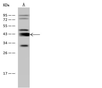 ADA / Adenosine Deaminase Antibody - Anti-ADA rabbit polyclonal antibody at 1:500 dilution. Lane A: Jurkat Whole Cell Lysate. Lysates/proteins at 30 ug per lane. Secondary: Goat Anti-Rabbit IgG (H+L)/HRP at 1/10000 dilution. Developed using the ECL technique. Performed under reducing conditions. Predicted band size: 41 kDa.