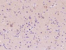 ADA / Adenosine Deaminase Antibody - Immunochemical staining of human ADA in human brain with rabbit polyclonal antibody at 1:2000 dilution, formalin-fixed paraffin embedded sections.
