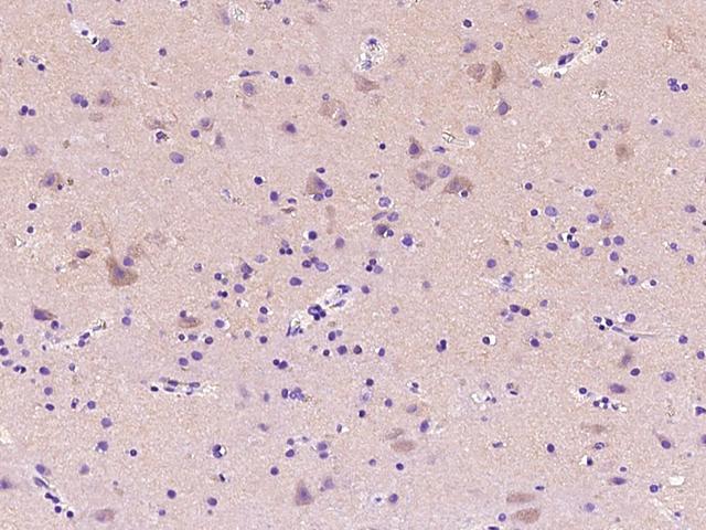 ADA / Adenosine Deaminase Antibody - Immunochemical staining of human ADA in human brain with rabbit polyclonal antibody at 1:2000 dilution, formalin-fixed paraffin embedded sections.