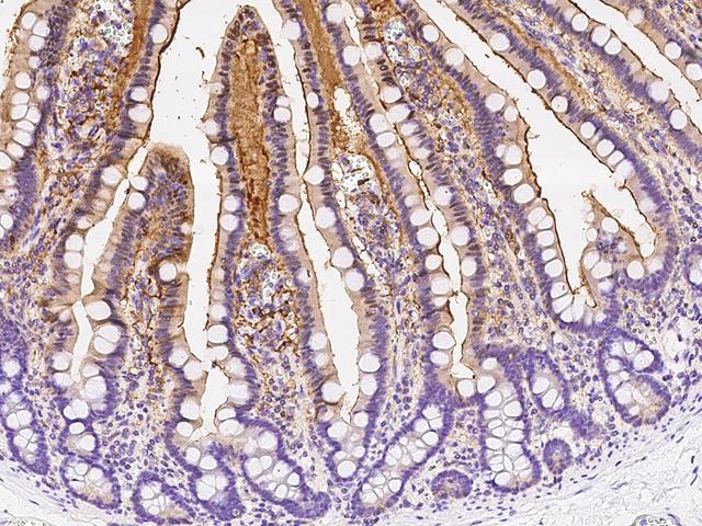 ADA / Adenosine Deaminase Antibody - Immunochemical staining of human ADA in human duodenum with rabbit polyclonal antibody at 1:2000 dilution, formalin-fixed paraffin embedded sections.