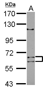 ADAD1 Antibody - Sample (30 ug of whole cell lysate) A: NT2D1 7.5% SDS PAGE ADAD1 / Tenr antibody diluted at 1:2000