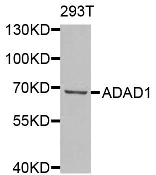 ADAD1 Antibody - Western blot analysis of extracts of 293T cells.