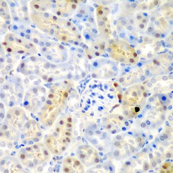 ADAD1 Antibody - Immunohistochemistry of paraffin-embedded Mouse kidney using ADAD1 Polyclonal Antibody at dilution of 1:200 (40x lens).