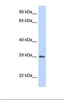 ADAL Antibody - Western blot of Human Transfected 293T. ADAL antibody dilution 1.0 ug/ml.  This image was taken for the unconjugated form of this product. Other forms have not been tested.