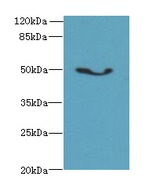 ADAL Antibody - Western blot. All lanes: ADAL antibody at 6 ug/ml+Mos- kidney tissue Goat polyclonal to rabbit at 1:10000 dilution. Predicted band size: 40 kDa. Observed band size: 50 kDa.