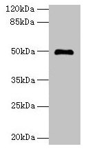 ADAL Antibody - Western blot All lanes: ADAL antibody at 6µg/ml + Mouse kidney tissue Secondary Goat polyclonal to rabbit IgG at 1/10000 dilution Predicted band size: 41, 31, 38 kDa Observed band size: 50 kDa