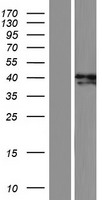 ADAL Protein - Western validation with an anti-DDK antibody * L: Control HEK293 lysate R: Over-expression lysate