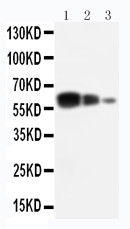 ADAM10 Antibody - WB of ADAM10 antibody. All lanes: Anti-ADAM10 at 0.5ug/ml. Lane 1: Recombinant Human ADAM10 Protein 10ng. Lane 2: Recombinant Human ADAM10 Protein 5ng. Lane 3: Recombinant Human ADAM10 Protein 2.5ng. Predicted bind size: 55KD. Observed bind size: 60KD.