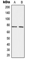 ADAM10 Antibody - Western blot analysis of CD156c expression in HeLa (A); SP2/0 (B) whole cell lysates.