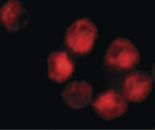 ADAM10 Antibody - Immunofluorescence of ADAM10 in K562 cells with ADAM10 antibody at 10 ug/ml.